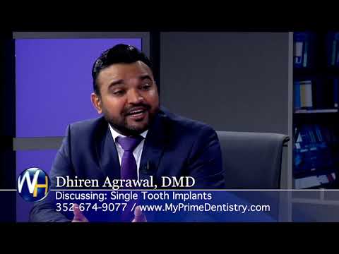 Single Tooth Implants with The Villages, FL dentist Dr. Dhiren Agrawal